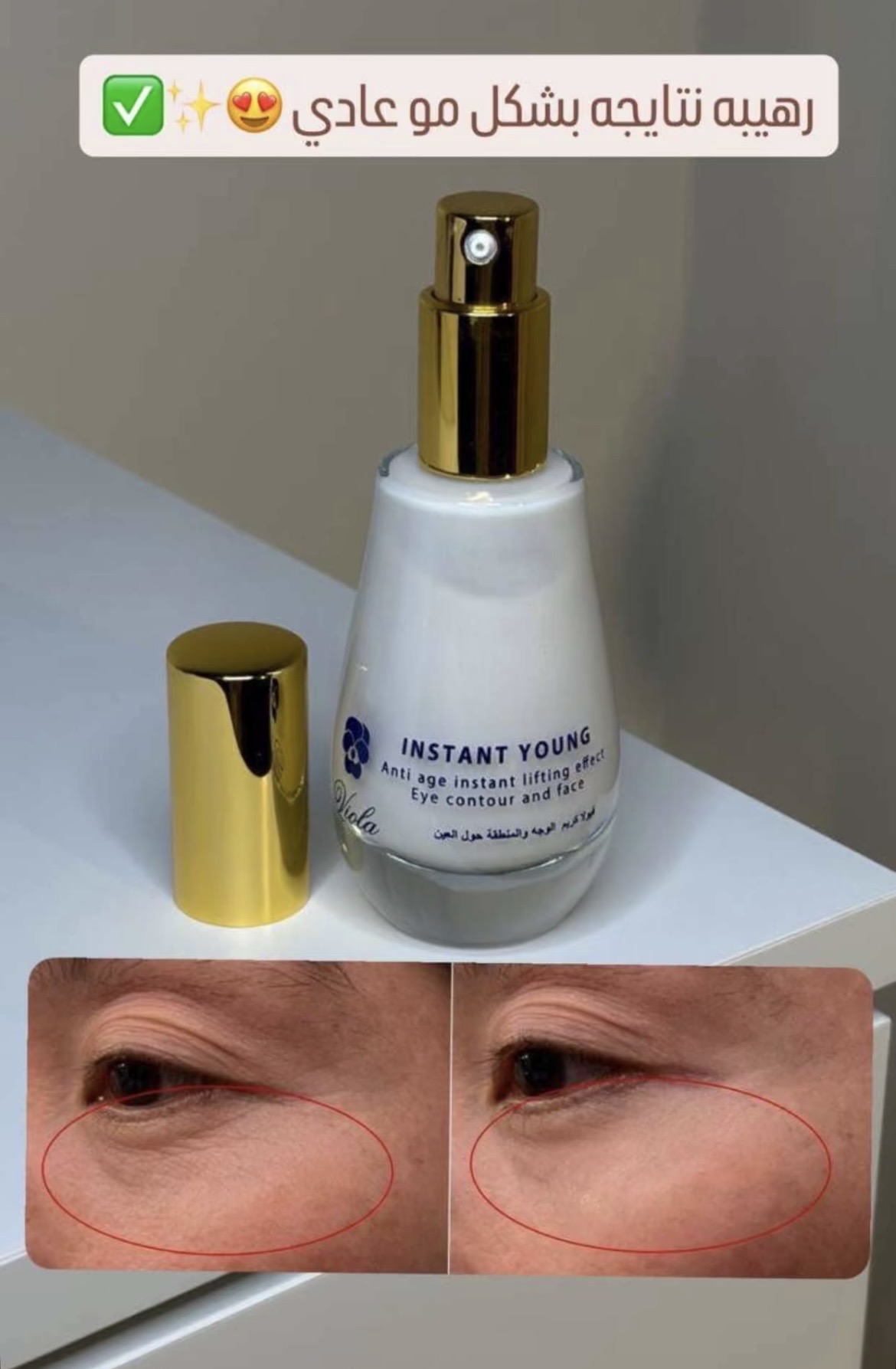 Review Add images